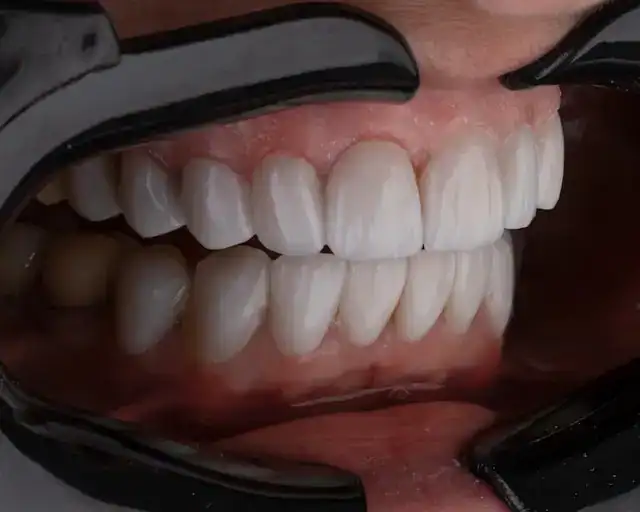 Dental 6
